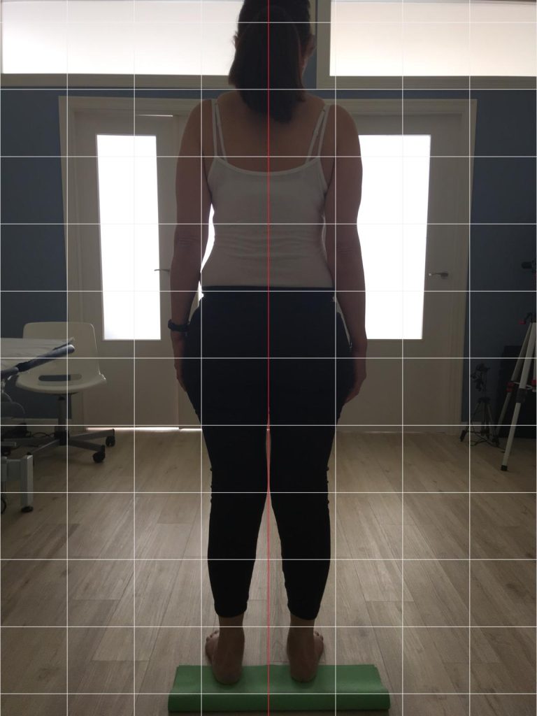 Estudio podostural biomecanico